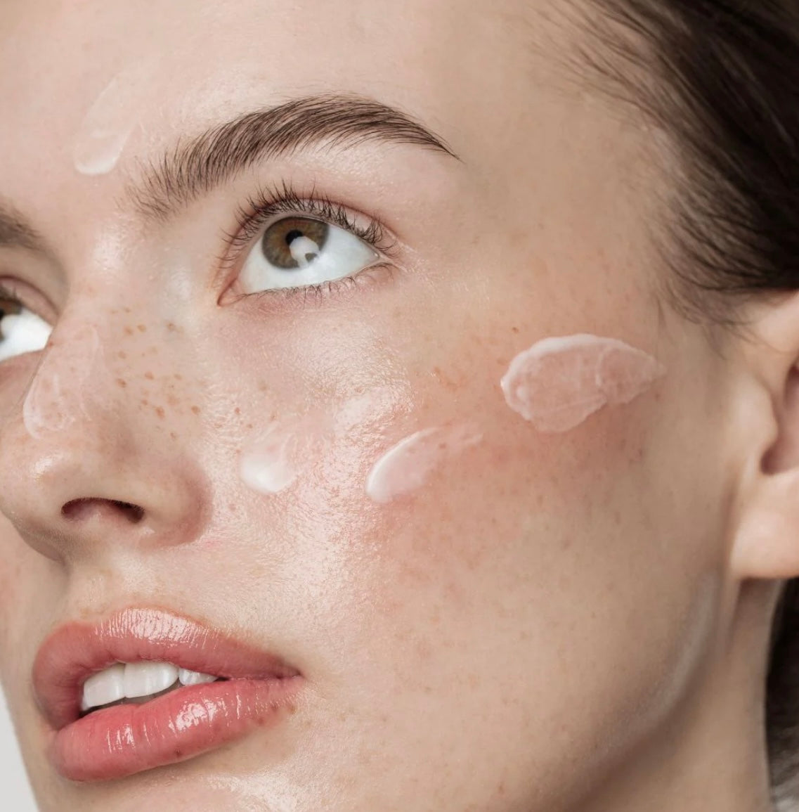 An-Dew 10% Azelaic Acid Serum