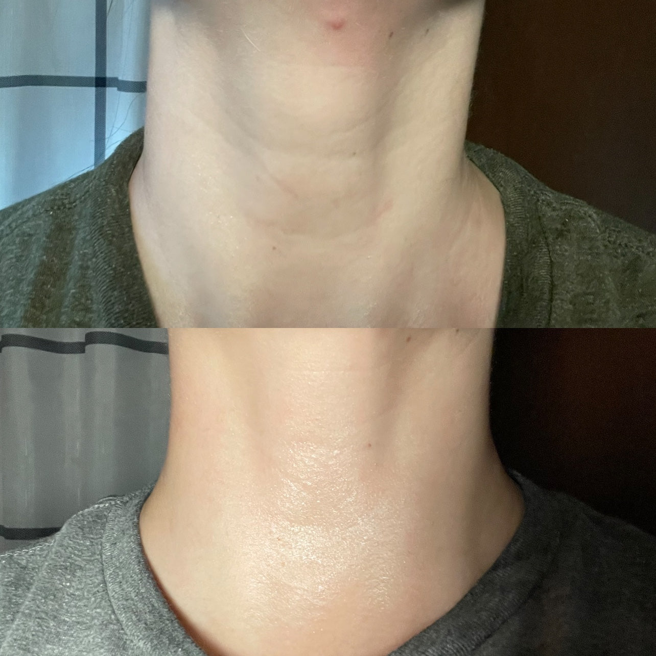 Techno Neck Perfecting Cream (Pre-Order)